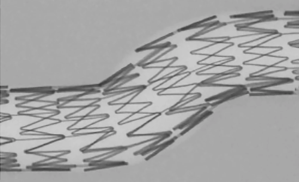 edu-cg-035-01-apposition-microct