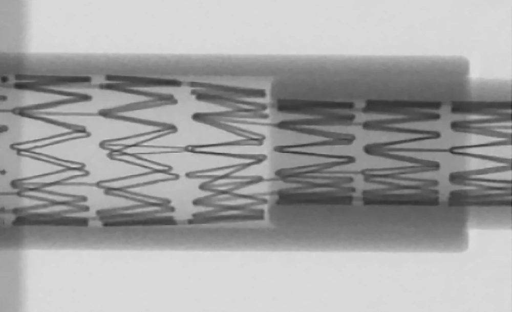 edu-cg-035-01-conformability-microct